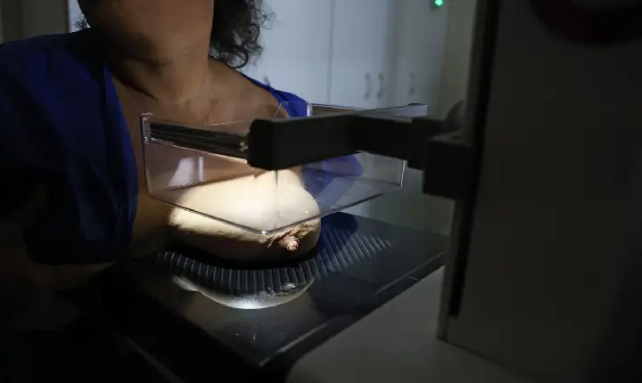 ANS defende que plano cubra mamografia digital sem restrição de idade