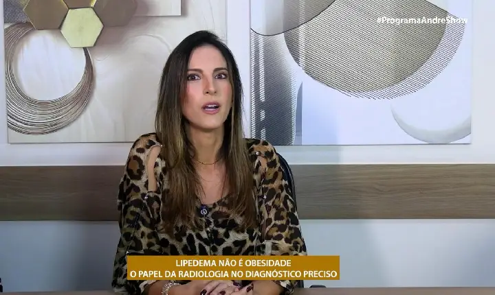 LIPEDEMA NÃO É OBESIDADE - O PAPEL DA RADIOLOGIA NO DIAGNÓSTICO PRECISO
